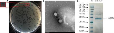 Genomic, Morphological and Functional Characterization of Virulent Bacteriophage IME-JL8 Targeting Citrobacter freundii